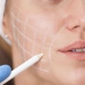 Understanding Follow-Up Care in Aesthetic Clinic Reviews Across the UK