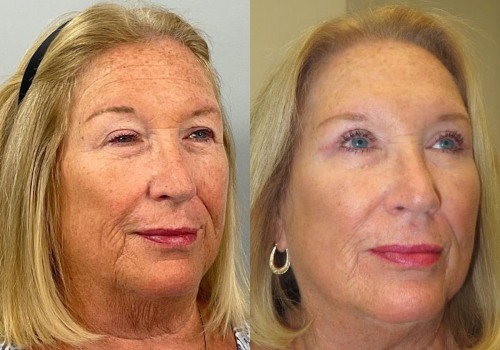 Exploring Aesthetic Clinic Reviews in the UK: The Role of Before and After Photos