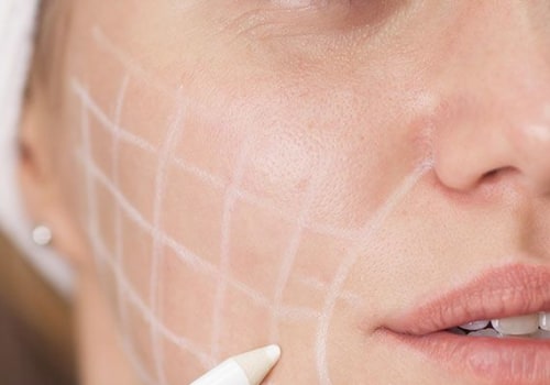 Understanding Follow-Up Care in Aesthetic Clinic Reviews Across the UK